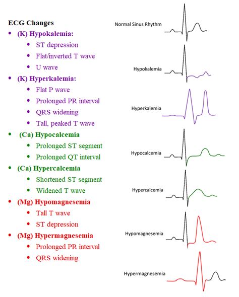 Visual For Ecg Changes For Different Electrolyte Imbalances Nursing