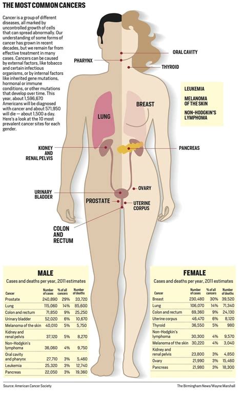 Most Common Kinds Of Cancer In Men And Women A Full Body Graphic Al Com