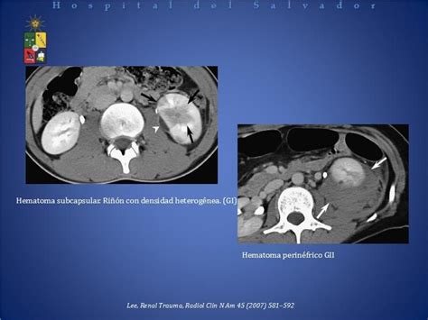 Simple Science: How to Make a Volcano with Kids