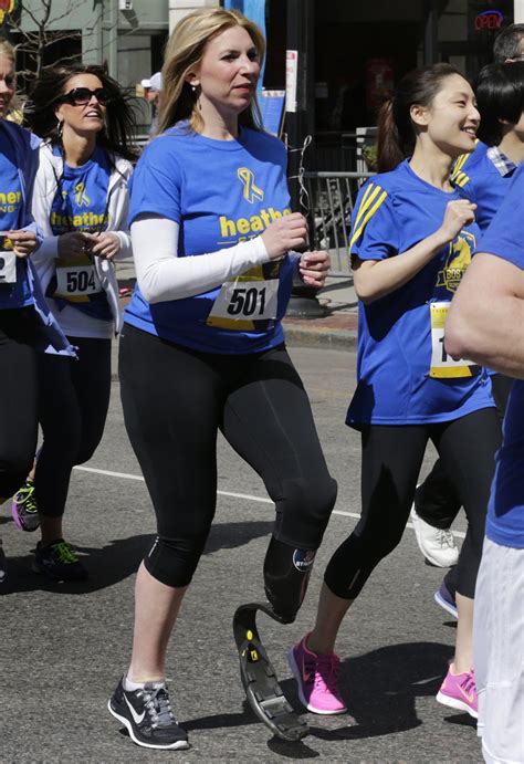 Boston Bombing Survivors Charity Gives 1st Artificial Limb