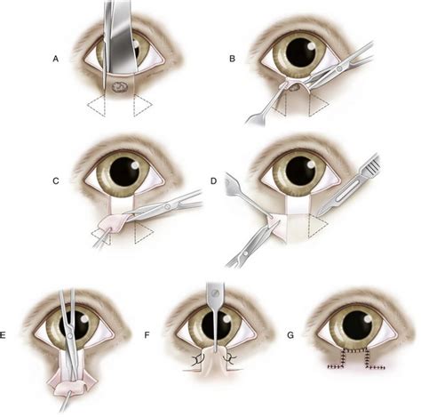 Basic Ophthalmic Surgical Procedures Veterian Key