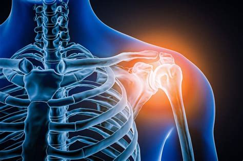 Shoulder Blade Pain Relief Tips And Tricks