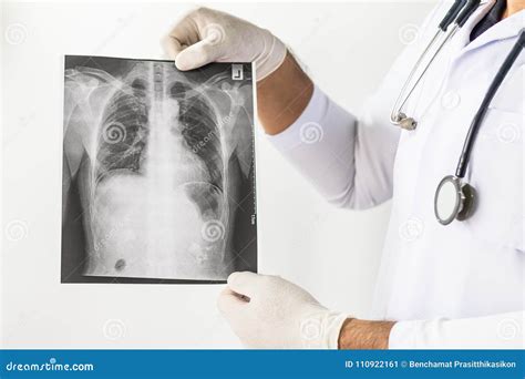 Doctor Examining A Lung Radiography Doctor Looking Chest X Ray Film