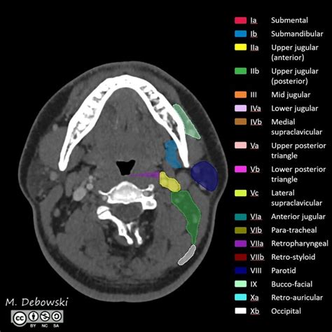 Ct Anatomy Of Neck Anatomical Charts And Posters