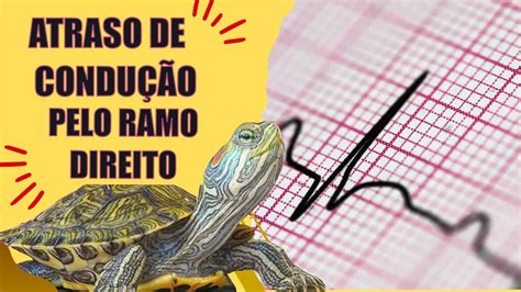 Atraso Final De Condução Sintomas