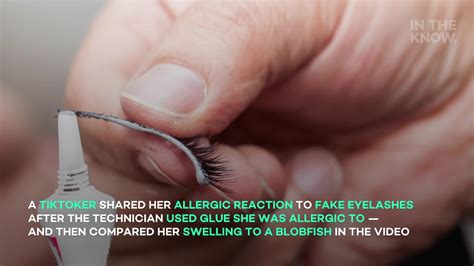 Woman Shares Allergic Reaction To Eyelash Extensions Video