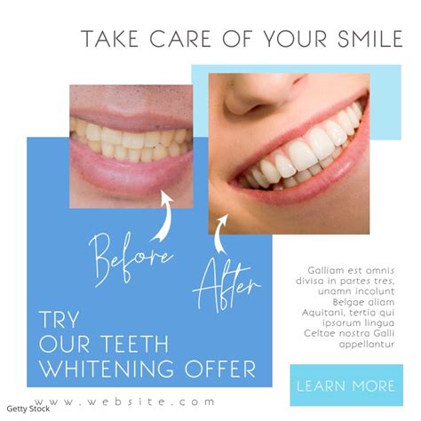 Copy Of Teeth Whitening Before And After Advertising Postermywall