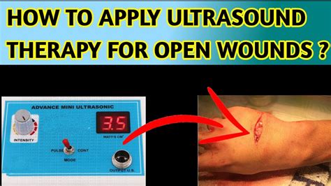 Therapeutic Ultrasound Can Heal Wounds How To Apply Ultrasound Therapy