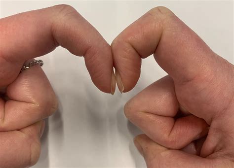A risk factor is anything that increases the chance that a person will develop a family history of lung cancer. This Simple Finger Test Could Reveal Signs of Lung Cancer ...