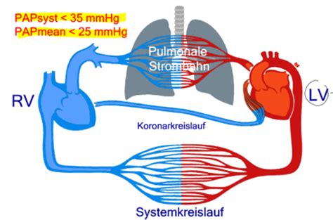 Pulmonale Hypertonie Cor Pulmonale Karteikarten Quizlet