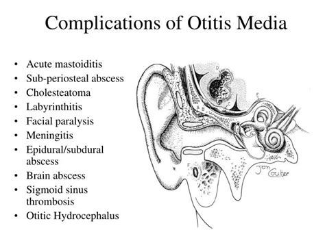 Ppt Ear Iv Complications Of Suppurative Otitis Media Powerpoint My
