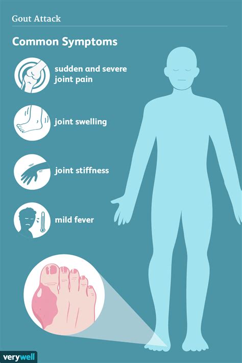 Gout Signs Symptoms And Complications
