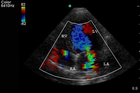 Valve cardiaque — une valve cardiaque est un élément du cœur séparant les différentes cavités et empêchant le sang de refluer dans le mauvais sens. Les problèmes cardiaques chez les chiens et les chats ...