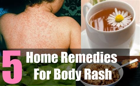 5 Treat Skin Rashes With Natural Remedies How To Get Rid Of Body