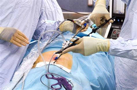Hernia Operation Stock Image M5510465 Science Photo Library