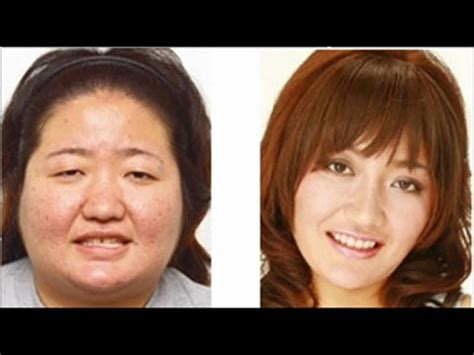 Japan Plastic Surgery Youtube