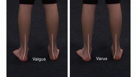 Surface anatomy