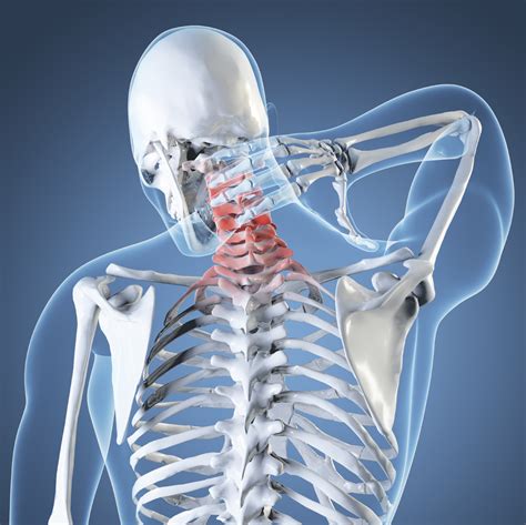 Whiplash Kevin Hall Physiotherapy Brighton And Hove Sussex