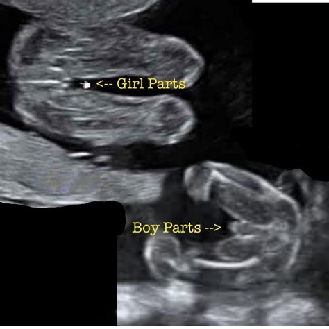 Most realistic personalized ultrasounds on the web! 20 week ultrasound Archives | Peanut Mom