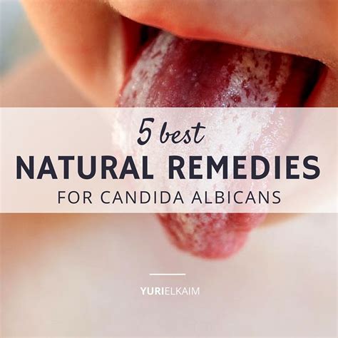 5 Best Natural Remedies For Candida Albicans Yuri Elkaim Candida