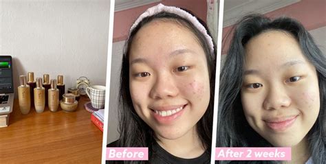 I Reset My Skin With A 5 Step Korean Skincare Routine Now That Makeup Is Not Needed While