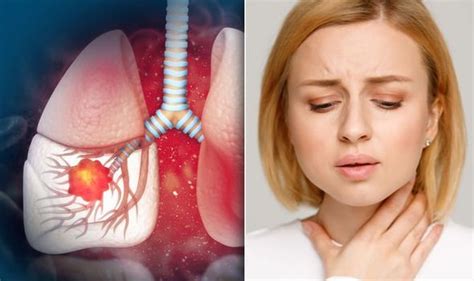 Lung Cancer Symptoms Signs Of A Tumour In Your Voice Include Having A
