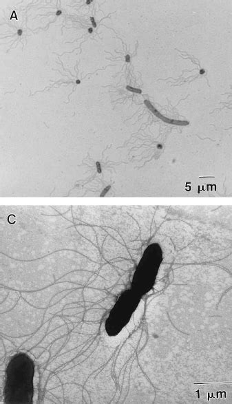 A number of its serovars are serious human pathogens. Salmonella enteritidis