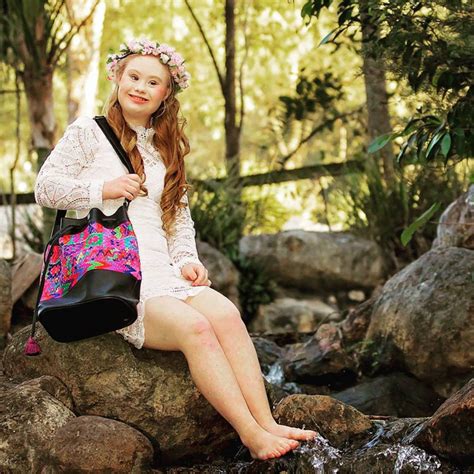 This Teen Model With Down Syndrome Is The New Face Of A Fashion