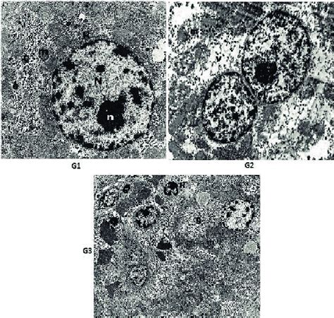 An Electron Micrograph Of The Control Group Rat Liver Cell G1