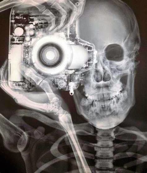 Tecnicos Radiologos C Mo Hacer Visible A La Radiolog A M Dica