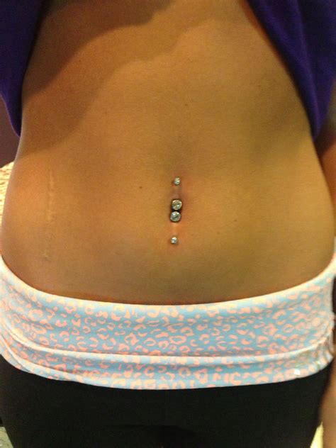 Keloid On Belly Piercing Pictures