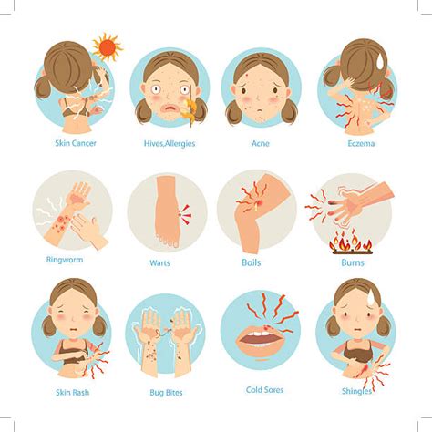 Royalty Free Eczema Clip Art Vector Images And Illustrations Istock