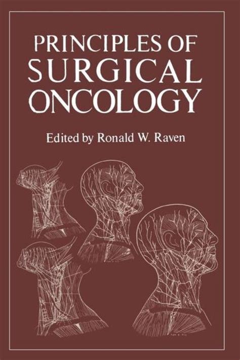 Principles Of Surgical Oncology 9781468423037 Onbekend Boeken
