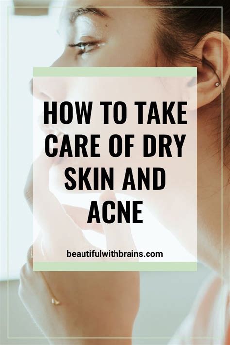 How To Deal With Acne And Dry Skin Skin Care Tips Dry Skin Oily Skin