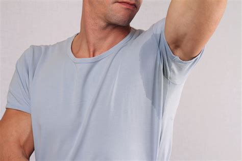 Excessive Sweating New You Chicago