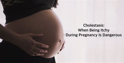 Cholestasis When Being Itchy During Pregnancy Is Dangerous Embry
