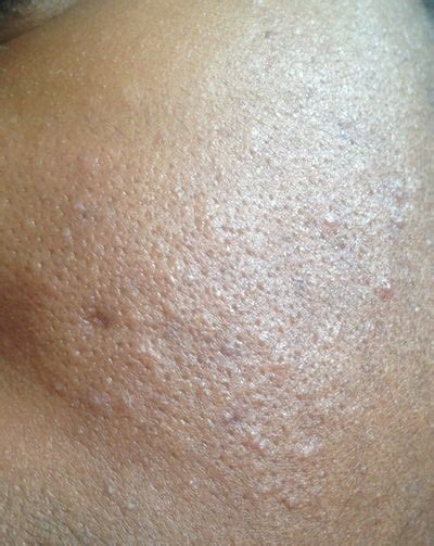 What Is This Skin Condition On My Face Photo Doctor Answers Tips