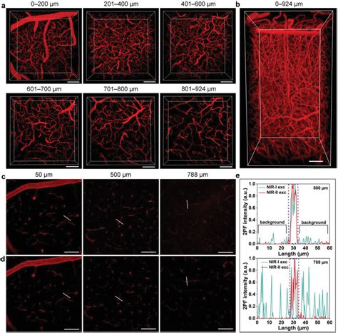 Intravital Imaging Of Mouse Brain Vasculature Network Labeled By Btpetq