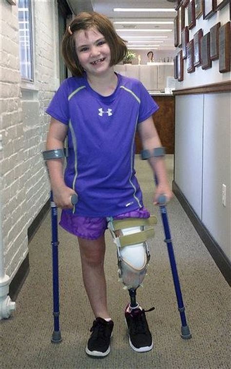 Boston Bomb Survivor 7 Using New Prosthetic Leg