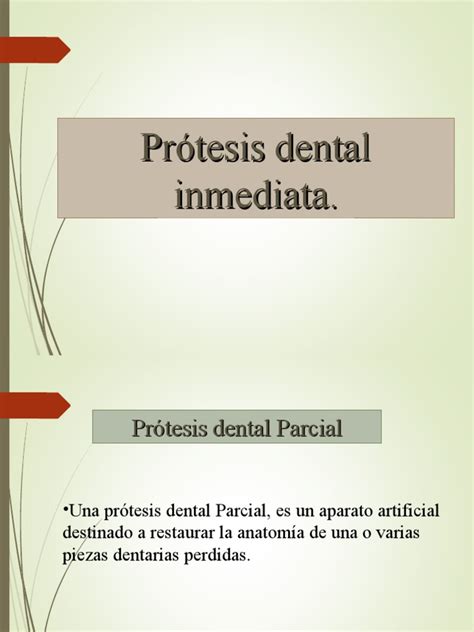 Clase PrÃ Tesis Dental Inmediata Pdf Dentadura Postiza Odontología