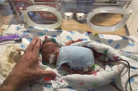 Baby Who Weighed One Pound After Being Born 12 Weeks Early Saved By