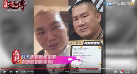 Jun 12, 2021 · 本港新冠肺炎疫情有緩和跡象，政府將接種復必泰新冠疫苗年齡降至12至15歲，政府專家顧問、中大呼吸系統科講座教授許樹昌今日（12日）出席一個電台節目時表示，相關青少年若曾對多種食物或超過一種藥物有即時嚴重副作用，在接種疫苗前應先諮詢過敏科醫生，患有長期病的青少年，如果病情. 阿虎25歲「禿頭前」帥照曝光! 植髮過敏變野生館長 | ETtoday星光雲 | ETtoday新聞雲