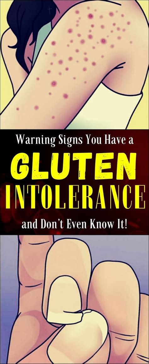 Warning Signs You Have A Gluten Intolerance And Dont Even Know It