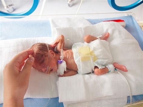 Understanding Premature Birth Causes And Care By Amandeep Hospital