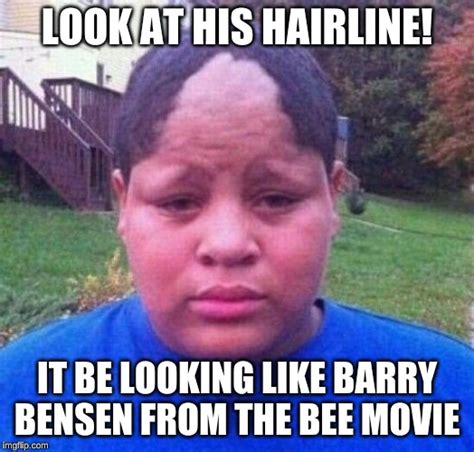 Bad Hairline Imgflip