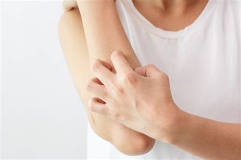 Prescribe only where necessary, and consider benefits versus risks. StudyPages - Have mild to moderate plaque psoriasis with ...