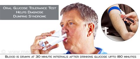 It is rarely used, and is never used to diagnose diabetes. Dumping Syndrome - Causes, Symptoms, Diagnosis, Treatment