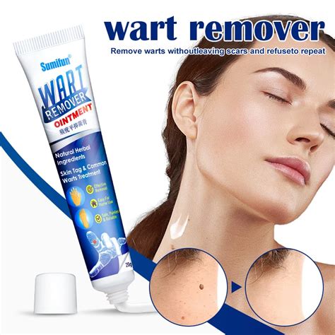 Wart Remover Cream Ointment Genital Herpes Genital Vulva Condyloma
