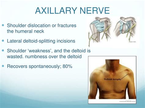 Eczema As Related To Axillary Nerve Dysfunction Pictures