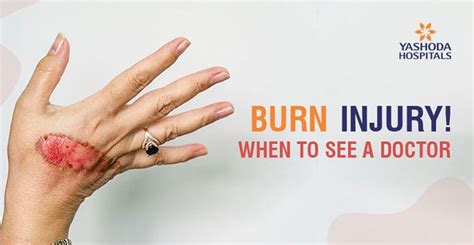 Burn Injury When To Seek Emergency Medical Care